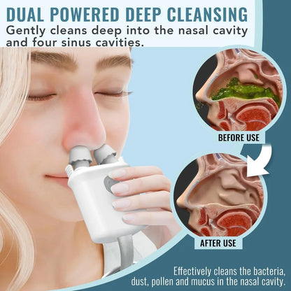 Nasal Irrigation System